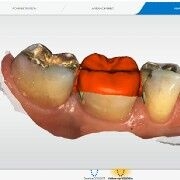 Volume measurement with OraCheck