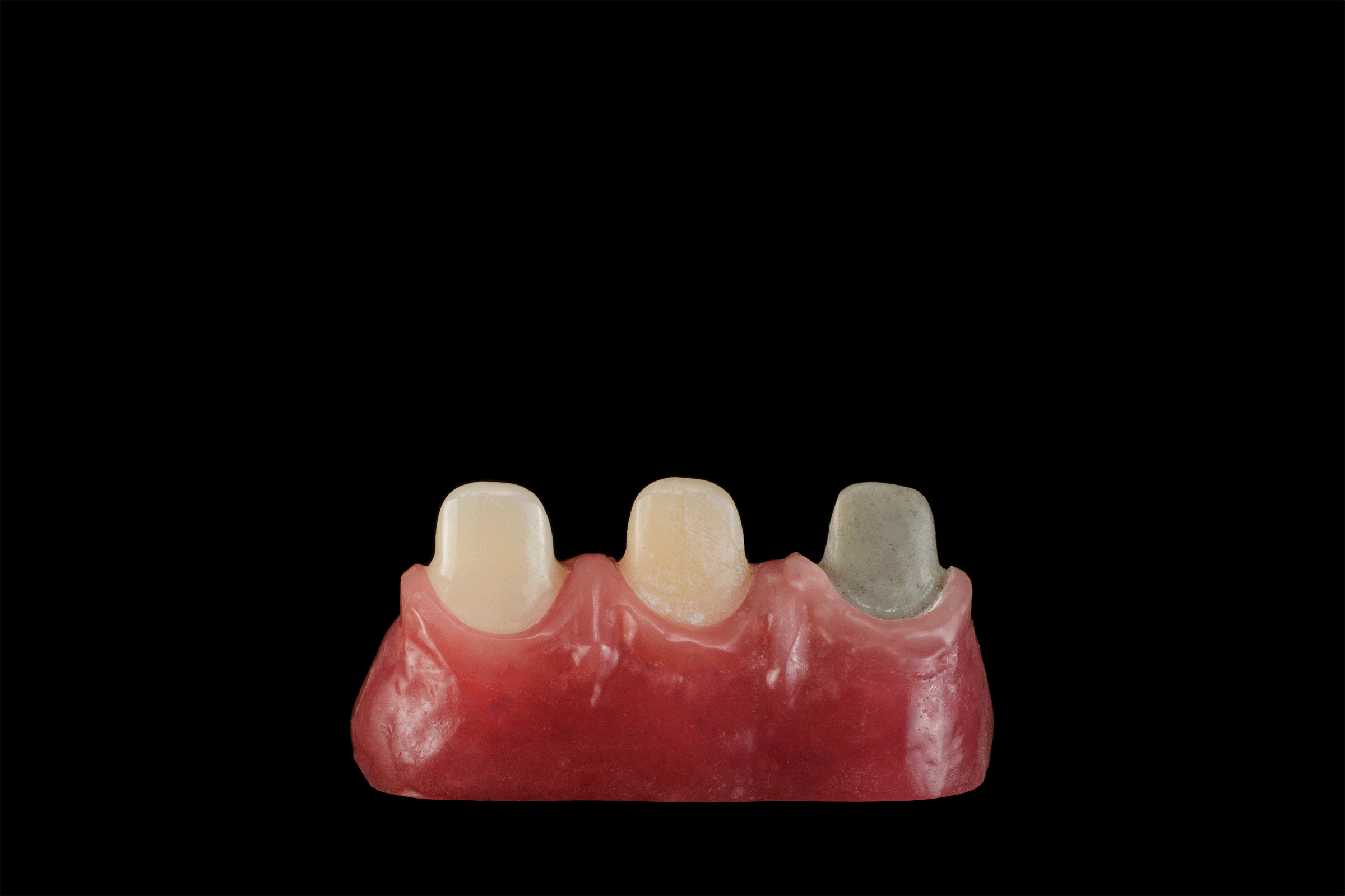 Acoperirea elementelor decolorate cu oxid de zirconiu Cercon ht ML