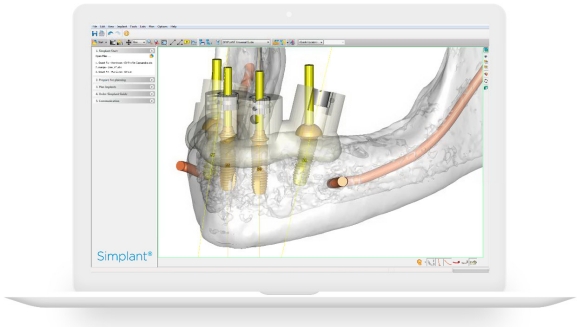 Simplant Pro 18