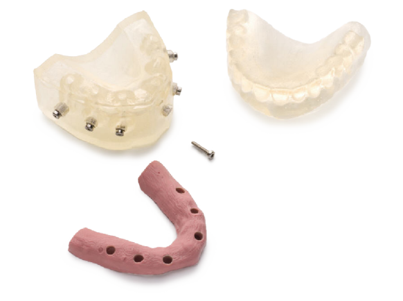 Immediate Smile Model